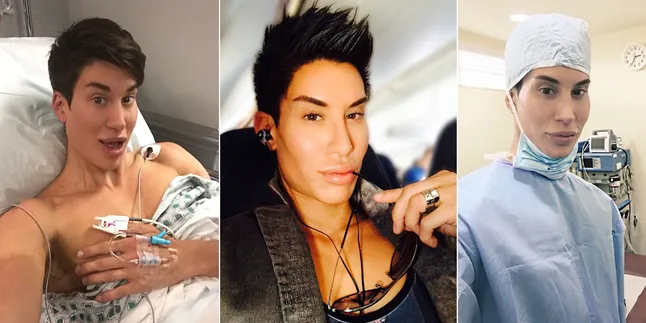 Berisiko Buta, Human Ken Doll Justin Jedlica Tetap Jalani Operasi Berisiko Buta, Human Ken Doll Justin Jedlica Tetap Jalani Operasi