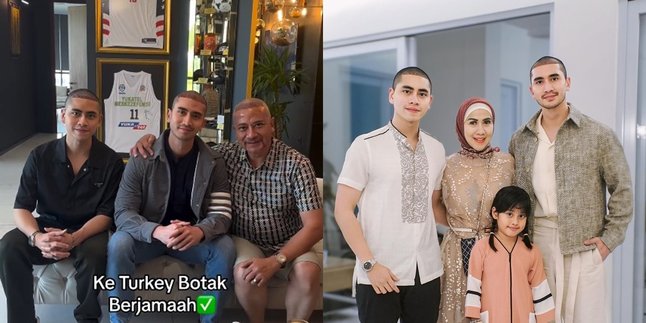 Bald Family, Here's a Portrait of Verrell Bramasta, Athalla Naufal, and their Father's Hair Transplant in Turkey