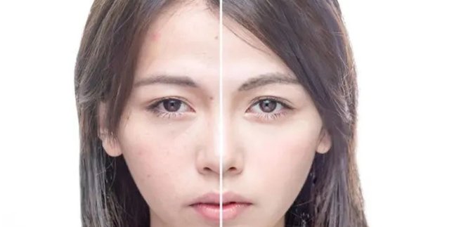 Cara Membuat Masker Alami untuk Regenerasi Kulit Wajah, Solusi Ampuh Mengatasi Flek Hitam Cara Membuat Masker Alami untuk Regenerasi Kulit Wajah, Solusi Ampuh Mengatasi Flek Hitam
