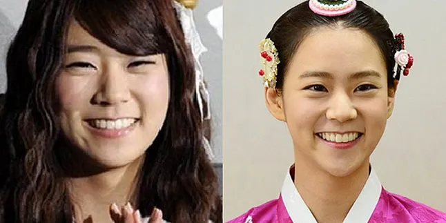 Dagu Lebih Lancip, Seung Yeon KARA Lakukan Operasi Plastik?