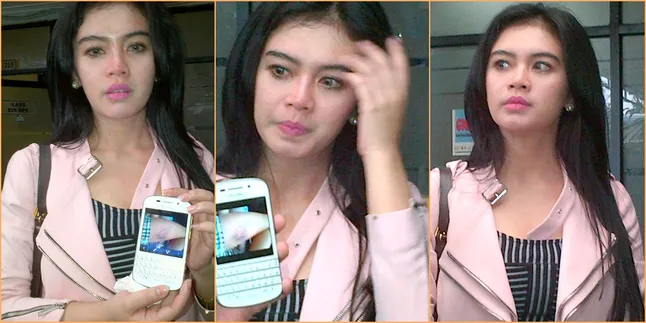 Dianiaya Mantan Kekasih, Artis Cantik Ini Lapor Polisi Dianiaya Mantan Kekasih, Artis Cantik Ini Lapor Polisi