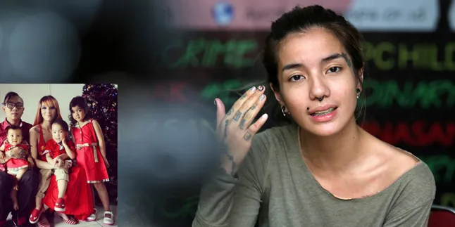 Dipukul Hingga Lebam Oleh Suami, Begini Kondisi Sheila Marcia Dipukul Hingga Lebam Oleh Suami, Begini Kondisi Sheila Marcia
