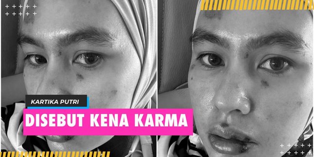 Called Karma, Kartika Putri Clarifies About Her Illness