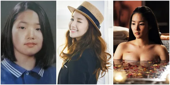 Transformasi Park Min Young, Mantan Lee Min Ho Yang Akui Oplas