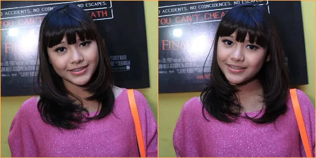 [Foto] Dagu Lancip Aurel Bukan Hasil Operasi Plastik, Tapi...