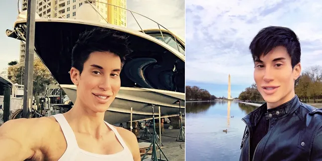 [Foto] Inilah Penampakan Hidung Justin Jedlica Sebelum Oplas