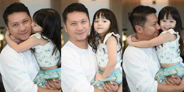 Gading Marten Ungkap Penyebab Mata Gempi Minus