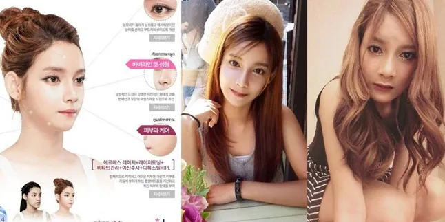Gila! Reality Show Korea Ini Sponsori 2 Wanita Operasi Plastik Gila! Reality Show Korea Ini Sponsori 2 Wanita Operasi Plastik