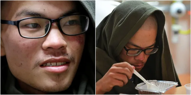 Hilang di Himalaya 47 Hari, Kaki Pemuda Ini Digerogoti Belatung