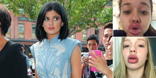 Ingin Bibir Sensual Bak Kylie Jenner, Mereka Malah Jadi 'Monster'