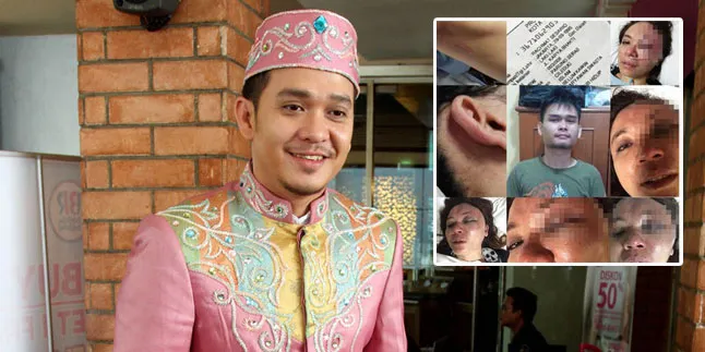 Ini Kronologi Adik Fadli & Fadlan Alami Tindak Penganiayaan Ini Kronologi Adik Fadli & Fadlan Alami Tindak Penganiayaan