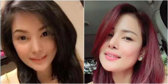Jalani 3 Operasi Plastik Sekaligus, Seorang Wanita Jadi Korban