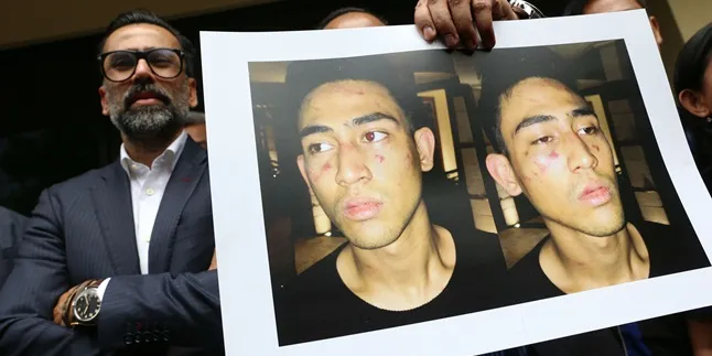 Jalani Tes Urine di RSPI, Axel Matthew Thomas Negatif Narkoba