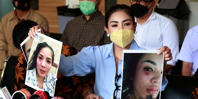 Responding to Accusations of Domestic Violence against Nindy Ayunda, Askara Parasady's Side: Could Fall and Hit the Table, Right?