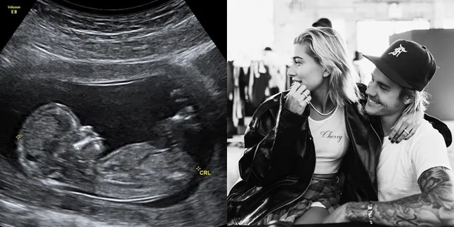 Justin Bieber Unggah Foto Hasil USG, Hailey Baldwin Hamil?