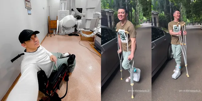 Latest News on Irwansyah After Suffering a Leg Fracture, Assisted with a Cane to Walk