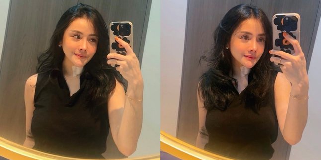 Addicted to Plastic Surgery to Look More Beautiful, Mawar AFI Admits Spending Hundreds of Millions