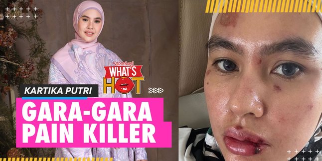 Complete Clarification of Kartika Putri About Her Face, 5 Years of Autoimmune - Rashes Due to Pain Killer