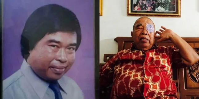 Komedian Senior Eddy Gombloh Meninggal Dunia di Usia 80 Tahun, Dulu Sering Muncul di Film Warkop DKI