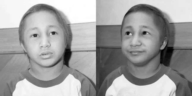 Kronologi Meninggalnya Dicky Topan, Kondisi Terakhir Perut Kembung dan Kaki Kaku