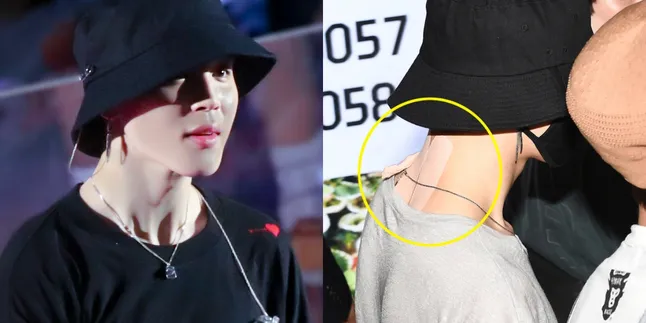 Leher Belakang Diperban, Jimin BTS Buat Penggemar Cemas Leher Belakang Diperban, Jimin BTS Buat Penggemar Cemas
