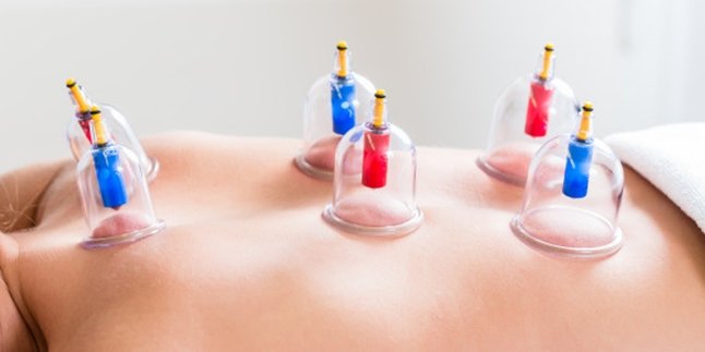 12 Benefits of Cupping When Done Routinely, Can Overcome Acne - Fertility