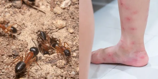 Memiliki Racun & Bisa Sebabkan Gangguan Kesehatan Kulit, Ini Bahaya Semut Charlie