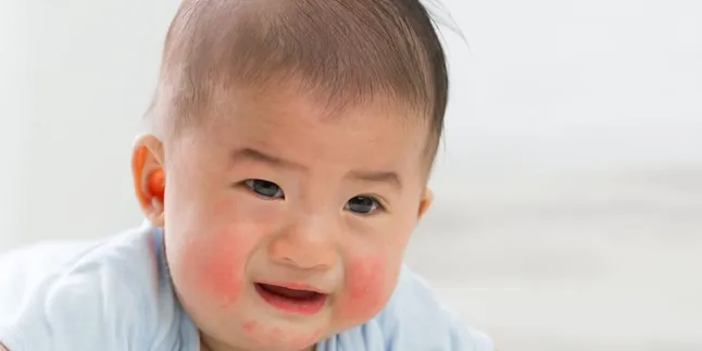 Mengenal Ciri Kuning pada Bayi: Gejala, Penyebab, dan Cara Penanganannya