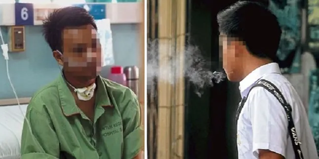 Merokok 5 Batang Per Hari, Pemuda 24 Tahun Idap Kanker Mulut!