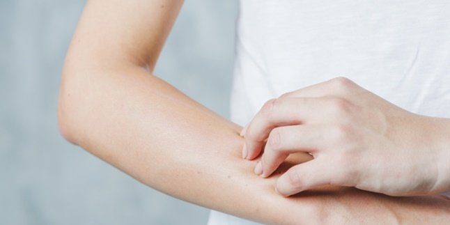 Easy to Find, Here are 9 Natural Itchy Medicine that Effectively Overcomes Rashes - Allergies