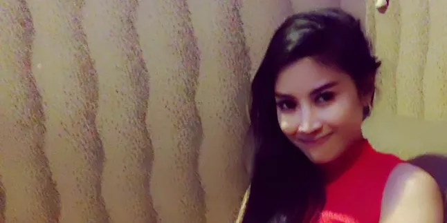 Muka Sampai Gigi Rusak, Pemain GGS Cantik Ini Kapok Naik Motor