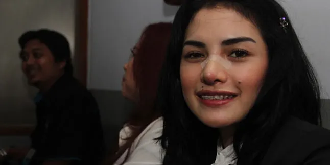 Nikita Mirzani Operasi Hidung Demi Pemotretan Playboy