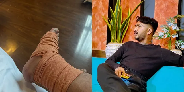 Onadio Leonardo Alami Insiden saat Manggung hingga Kakinya Diperban Onadio Leonardo Alami Insiden saat Manggung hingga Kakinya Diperban