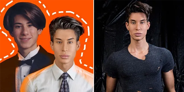 Oplas Ratusan Kali, Ini Curhatan Human Ken Doll Justin Jedlica