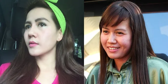 Pedangdut Nita Thalia Buka-Bukaan Mengaku Oplas, Apa Alasannya? Pedangdut Nita Thalia Buka-Bukaan Mengaku Oplas, Apa Alasannya?