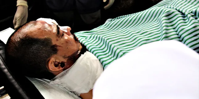 Pengamat Musik: Pelaku Penyiraman Beery Saint Loco Biadab!