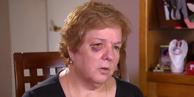 Penggemar Baseball ini Ditembak Dengan Hot Dog di Matanya