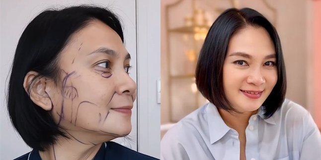 Dian Nitami's Transformation Over Time After Plastic Surgery, Results Are Already Visible