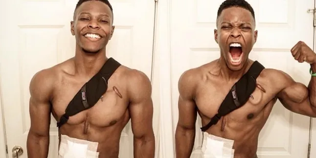 Pria Kekar Ini Simpan Jantungnya Dalam Ransel, Kok Bisa?