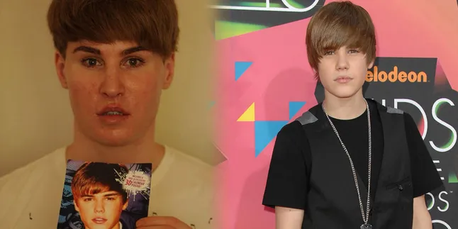 Penyebab Kematian Pria Mirip Justin Bieber Ini Telah Ditemukan