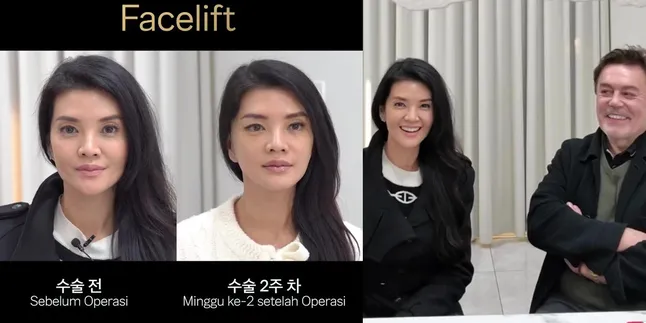 Decided to Undergo Plastic Surgery, Farah Quinn's Facial Transformation Now Looks Younger