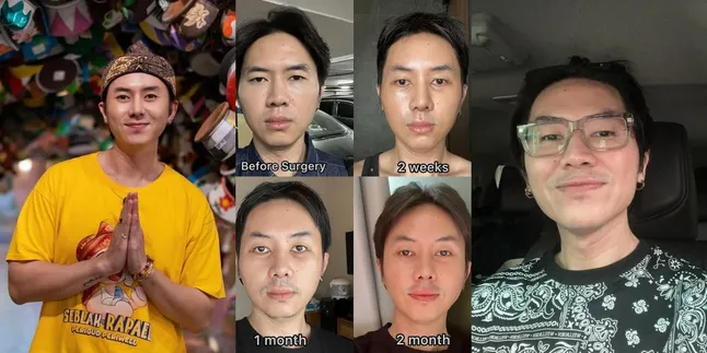 Rafael Tan Undergoes Three Surgical Procedures at Once in South Korea, Here's Why