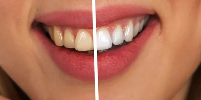 Natural Secrets to Whiten Yellow Teeth, An Effective Solution You Must Try