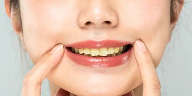 The Secret to Whitening Yellow Teeth, Salt and This One Magical Ingredient You Must Try