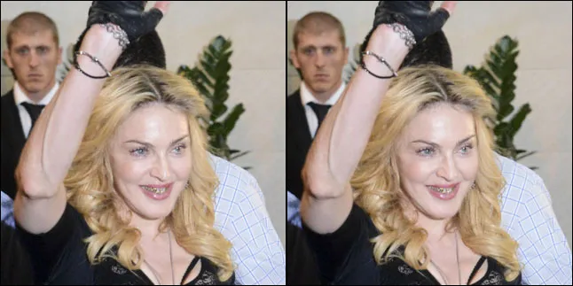 Reaksi Publik Melihat Gigi Emas Madonna