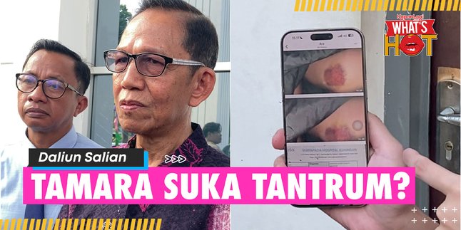 Tamara Tyasmara's Friend Reveals Photo Evidence of Bruises Alleging Violence, Yudha Arfandi's Side Provides Defense