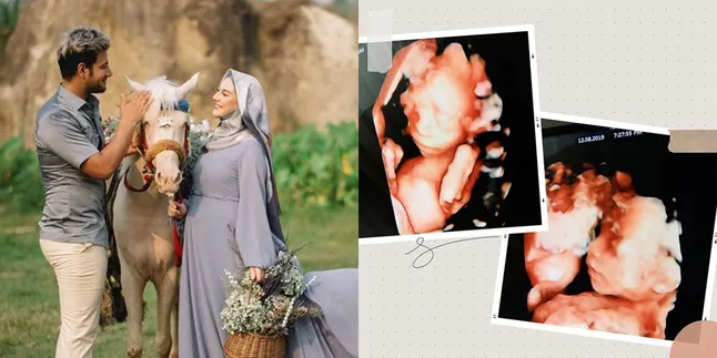 Sederet Fakta Bayi Kembar Irish Bella dan Ammar Zoni yang Meninggal Dunia