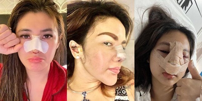 Blak-Blakan! These Celebrities Undergo Nose Plastic Surgery at Fantastic Prices, Boosting Their Confidence - Their Pictures Now Grab Attention