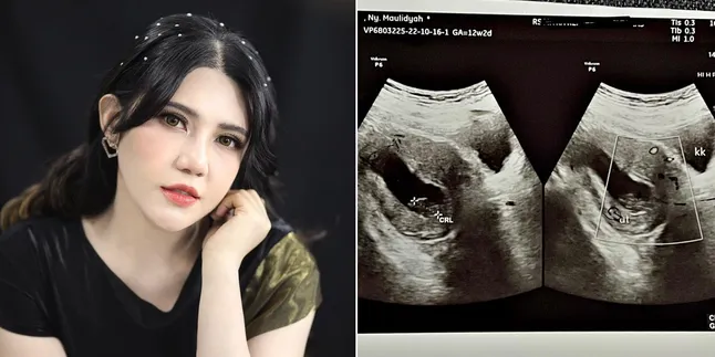 Sedih, Via Vallen Kembali Curhat Soal Janin yang Tak Berkembang