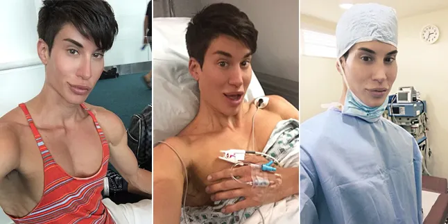 Serba Mewah & Mahal, Ini Kehidupan Human Ken Doll Justin Jedlica